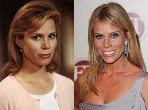 kontakt At redigere Lav aftensmad The Mystery behind Cheryl Hines Plastic Surgery Scandals